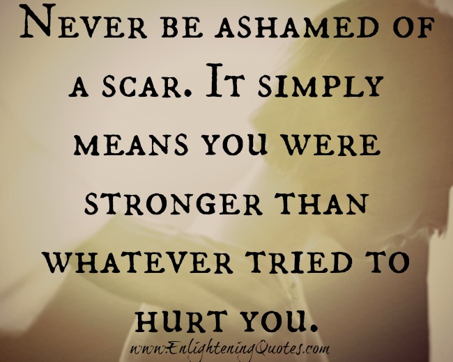 Never be ashamed of a scar